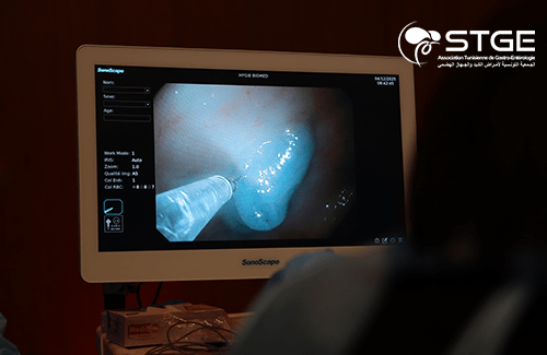 29<sup>ème</sup> Congrès national de la Société Tunisienne de Gastro-entérologie 2025